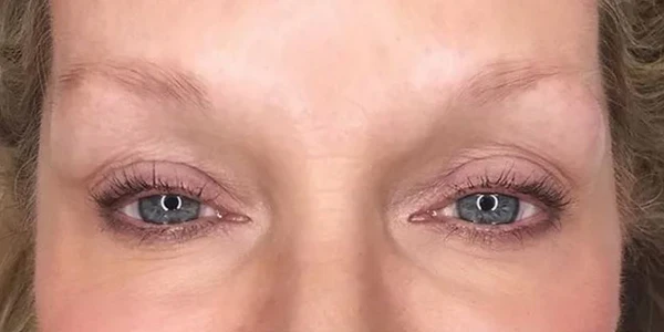 These 4 Easy Steps Helped Me Reverse My Thinning Eyebrows